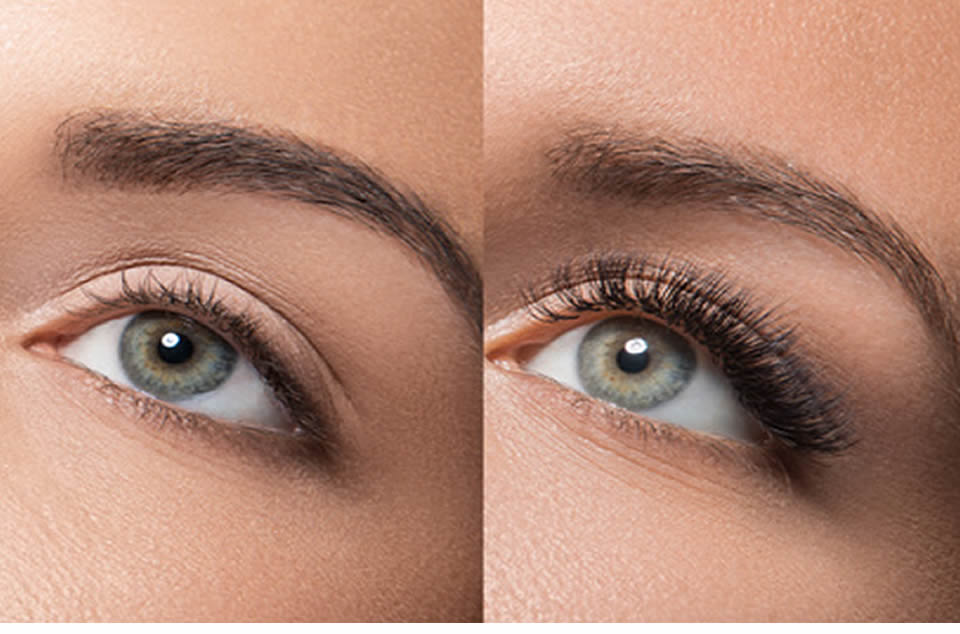 Le BOTOX DES CILS